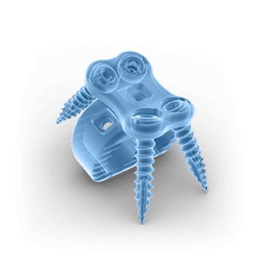Illustration_COMP_03-ANT-LAT-1 Anterior lateral interbody