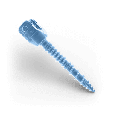 Illustration_COMP_03-POST-FIX-1 Posterior fixation