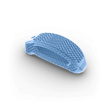 Illustration_COMP_03-POST-INT-1 Posterior interbody